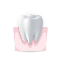 How often do you experience bleeding while brushing or flossing?